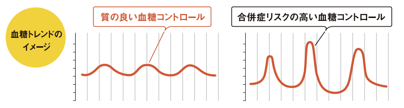 血糖トレンドのイメージ 質の良い血糖コントロールはグラフの波の上下動が小さい、合併症リスクの高い血糖コントロールはグラフの波の上下動が大きい