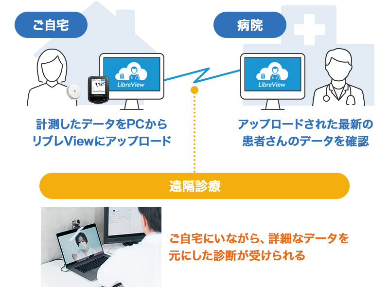 ご自宅で計測したデータをPCからリブレViewにアップロード、病院でアップロードされた患者さんのデータを確認 ご自宅と病院間で遠隔診療を行い、ご自宅にいながら、詳細なデータを元にした診断が受けられる